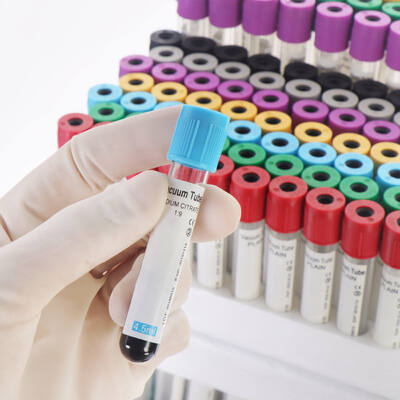 Αγορά Vacuum EDTA Blood Tubes for Complete Blood Count (CBC) – High Quality, Secure Seal σε απευθείας σύνδεση κατασκευή