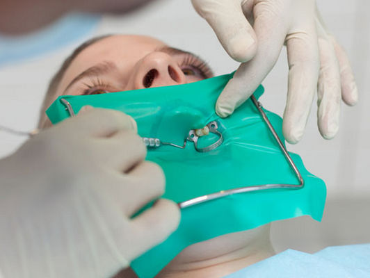 Καλή τιμή Οδοντικά καθαρά Retractor μάγουλων φραγμάτων λατέξ οδοντικά υλικά λαστιχένια φύλλα φραγμάτων σε απευθείας σύνδεση